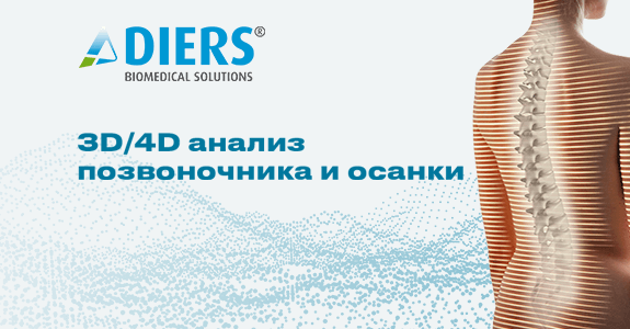 Diers (Германия)