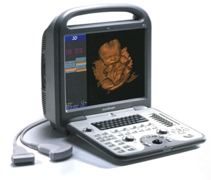 SonoScape S6