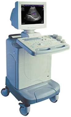 SonoScape SSI-5000
