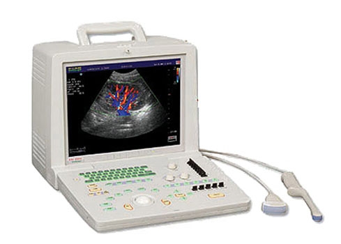 SonoScape SSI-1000
