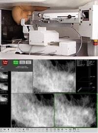 IMS Biopsy Digit