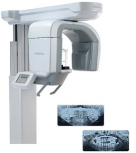 Pointnix Point 500 HD