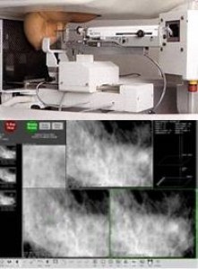IMS Biopsy Digit